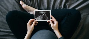 وسایل مورد نیاز برای عکاسی بارداری